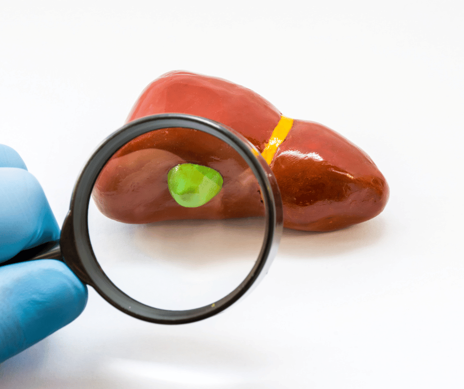 ¿Para qué sirve la Vesícula?