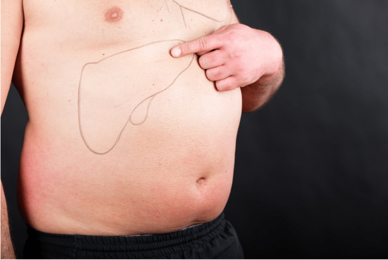 ¿Cómo es la cirugía de vesícula?